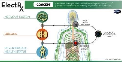 ElectRx系统的功能示意图《电子工程专辑》